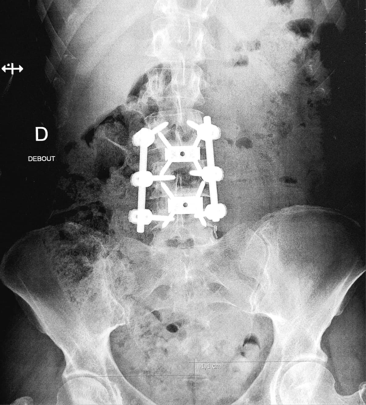 Observation du corps - méthode EPSSY